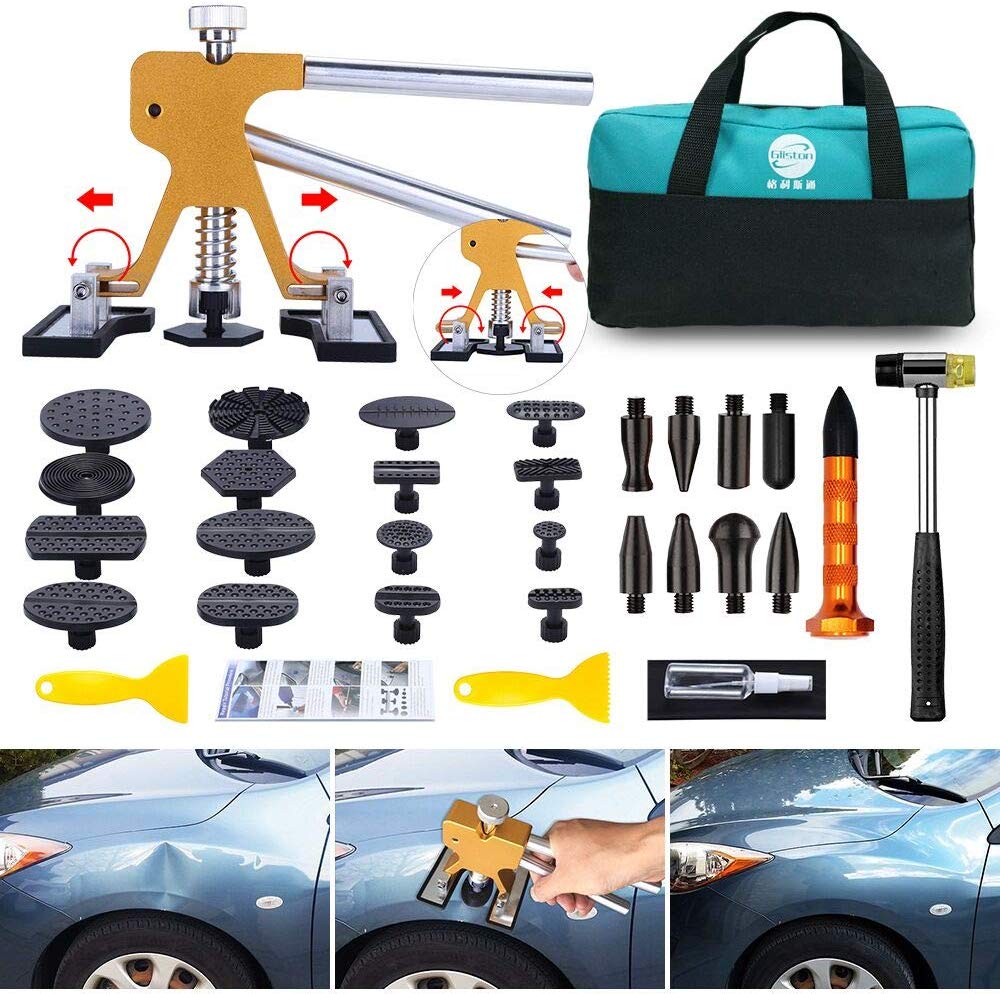 Dent Kit
